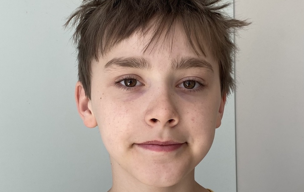 Jakob Albert 